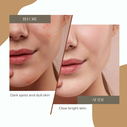 Vitamin C Brightening Serum – Say Goodbye to Dark Spots